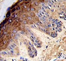 IHC testing of FFPE human skin tissue with Topoisomerase II alpha antibody. HIER: steam section in pH6 citrate buffer for 20 min and allow to cool prior to staining.