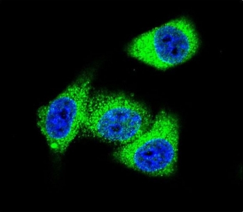 Immunofluorescent staining of human HeLa cells with Topoisomerase II alpha antibody (green) and DAPI nuclear stain (blue).