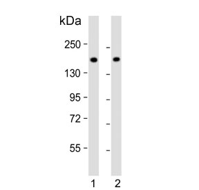 Western blot testing of human 1) Jurkat and 2) K562 cell lysate with Topoisomerase II alpha antibody. Predicted molecular weight ~174 kDa.