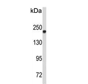 Western blot testing of human A375 cell lysate with Topoisomerase II alpha antibody. Predicted molecular weight ~174 kDa.