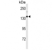 Western blot testing of mouse lung tissue lysate with XDH antibody. Predicted molecular weight ~146 kDa.