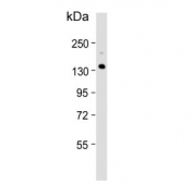 Western blot testing of human fetal liver tissue lysate with XDH antibody. Predicted molecular weight ~146 kDa.