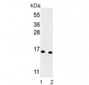Western blot testing of human 1) MCF-7 and 2) Jurkat cell lysate with Sm-D3 antibody. Predicted molecular weight ~14 kDa.