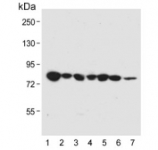 Western blot testing of human 1) HT-29, 2) WiDr, 3) K562, 4) A2058, 5) HL60, 6) mouse liver and 7) mouse lung lysate with Beta Glucuronidase antibody. Expected molecular weight: 68-75 kDa, also seen as dimers and tetramers.