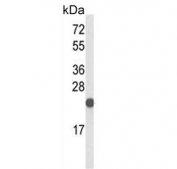 Western blot testing of mouse testis tissue lysate with CXXC4 antibody. Predicted molecular weight ~21 kDa.