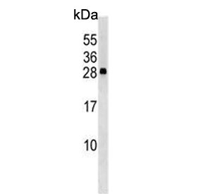 Western blot testing of human K562 cell lysate with CXXC4 antibody. Predicted molecular weight ~21 kDa.