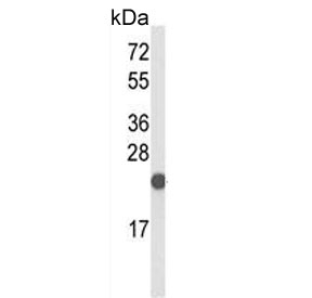 Western blot testing of mouse testis tissue lysate with CXXC4 antibody. Predicted molecular weight ~21 kDa.