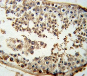 IHC testing of FFPE human testis tissue with CDKN2D antibody. HIER: steam section in pH6 citrate buffer for 20 min and allow to cool prior to staining.