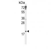 Western blot testing of mouse testis tissue lysate with CDKN2D antibody. Predicted molecular weight ~18 kDa.
