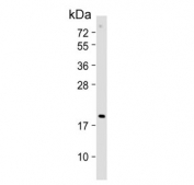 Western blot testing of human Jurkat cell lysate with CDKN2D antibody. Predicted molecular weight ~18 kDa.