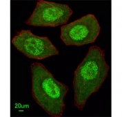 Immunofluorescent staining of human U-251 cells with FANCC antibody (green), DAPI nuclear stain (blue) and anti-Actin (red).