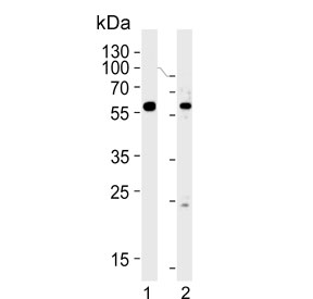 Western blot testing of human 1) HepG2 and 2) HL60 cell lysate with FANCC antibody. Predicted molecular weight ~63 kDa.