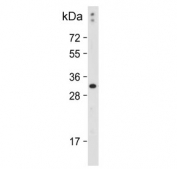 Western blot testing of rat skeletal muscle tissue lysate with Thyroxine 5-deiodinase antibody. Predicted molecular weight ~34 kDa, routinely observed at 31-37 kDa.