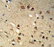 IHC testing of FFPE human brain tissue with NCOA7 antibody. HIER: steam section in pH6 citrate buffer for 20 min and allow to cool prior to staining.
