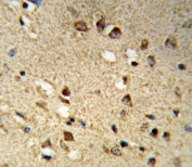 IHC testing of FFPE human brain tissue with NCOA7 antibody. HIER: steam section in pH6 citrate buffer for 20 min and allow to cool prior to staining.