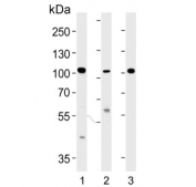 Western blot testing of 1) human Hela, 2) human MDA-MB-453 and 3) mouse kidney lysate with NCOA7 antibody. Predicted molecular weight ~106 kDa, may be observed at 120~140 kDa.