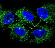 Immunofluorescent staining of human NCI-H460 cells with ADH7 antibody (green) and DAPI nuclear stain (blue).