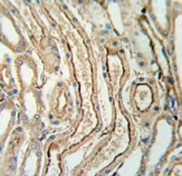 IHC testing of FFPE human lung tissue with ADH7 antibody. HIER: steam section in pH6 citrate buffer for 20 min and allow to cool prior to staining.