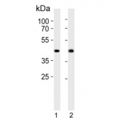 Western blot testing of human 1) HepG2 and 2) SW480 cell lysate with ADH7 antibody. Predicted molecular weight ~41 kDa.