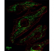 Immunofluorescent staining of human HeLa cells with Mitoferrin-1 antibody (green) and anti-Actin (red).