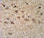 IHC testing of FFPE human brain tissue with Mitoferrin-1 antibody. HIER: steam section in pH6 citrate buffer for 20 min and allow to cool prior to staining.