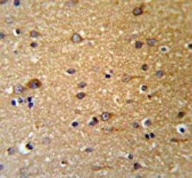 IHC testing of FFPE human brain tissue with ZDHHC9 antibody. HIER: steam section in pH6 citrate buffer for 20 min and allow to cool prior to staining.