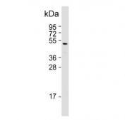Western blot testing of human skeletal muscle tissue with ZDHHC9 antibody. Expected molecular weight: 41-46 kDa.