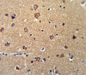 IHC testing of FFPE human brain tissue with ANKH antibody. HIER: steam section in pH6 citrate buffer for 20 min and allow to cool prior to staining.