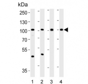 Western blot testing of 1) human SW620, 2) human PC-3, 3) mouse kidney and 4) rat kidney lysate with SUPV3L1 antibody. Predicted molecular weight ~88 kDa.