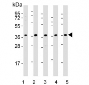 Western blot testing of human 1) HeLa, 2) HepG2, 3) Jukat, 4) LNCaP and 5) Raji cell lysate with DFFB antibody. Predicted molecular weight ~39 kDa.