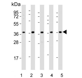 Western blot testing of human 1) HeLa, 2) HepG2, 3) Jukat, 4) LNCaP and 5) Raji cell lysate with DFFB antibody. Predicted molecular weight ~39 kDa.