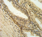 IHC testing of FFPE human prostate tissue with DFFB antibody. HIER: steam section in pH6 citrate buffer for 20 min and allow to cool prior to staining.