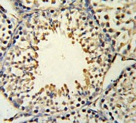 IHC testing of FFPE mouse testis tissue with ACSBG2 antibody. HIER: steam section in pH6 citrate buffer for 20 min and allow to cool prior to staining.