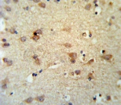 IHC testing of FFPE human brain tissue with LCAT antibody. HIER: steam section in pH6 citrate buffer for 20 min and allow to cool prior to staining.