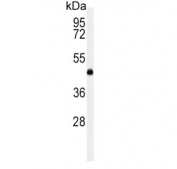 Western blot testing of human K562 cell lysate with LCAT antibody. Predicted molecular weight ~49 kDa.