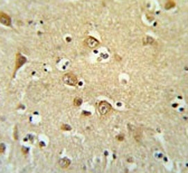 IHC testing of FFPE human brain tissue with Cadherin 20 antibody. HIER: steam section in pH6 citrate buffer for 20 min and allow to cool prior to staining.