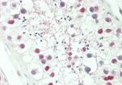 IHC testing of FFPE human testis tissue with HOXA3 antibody. HIER: steam section in pH6 citrate buffer for 20 min and allow to cool prior to staining.