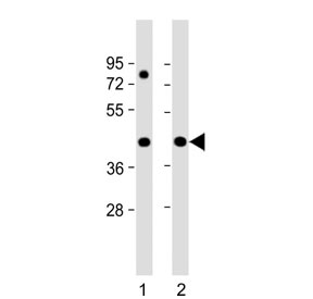 Western blot testing of human 1) HeLa and 2) Jurkat cell lysate with PRPF38A antibody. Predicted molecular weight ~37 kDa.