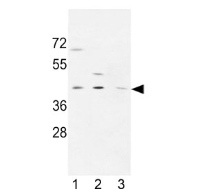 Western blot testing of human 1) MDA-MB-231, 2) CCRF-CEM and 3) HL60 cell lysate with PRPF38A antibody. Predicted molecular weight ~37 kDa.