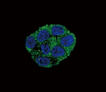 Immunofluorescent staining of human HepG2 cells with CaI-PLA2 antibody (green) and DAPI nuclear stain (blue).