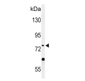 Western blot testing of human HepG2 cell lysate with CaI-PLA2 antibody. Expected molecular weight: 85-90 kDa.