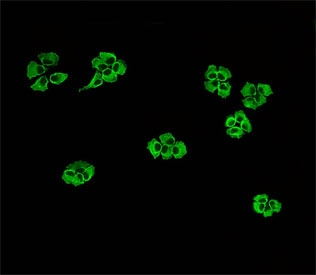 Immunofluorescent staining of human NCI-H460 cells with MAP3K13 antibody.