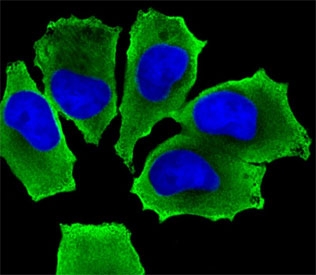 Immunofluorescent staining of human NCI-H460 cells with MAP3K13 antibody (green) and DAPI nuclear stain (blue).