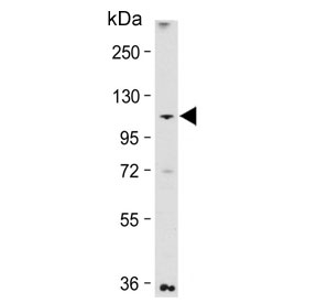 Western blot testing of human NCI-H460 cell lysate with MAP3K13 antibody. Predicted molecular weight ~108 kDa.