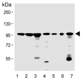 Western blot testing of 1) human K562, 2) human SH-SY-5Y, 3) human U-87 MG, 4) human HL60, 5) mouse cerebellum, 6) mouse brain and 7) rat cerebellum lysate with DNAJC6 antibody. Predicted molecular weight ~100 kDa.