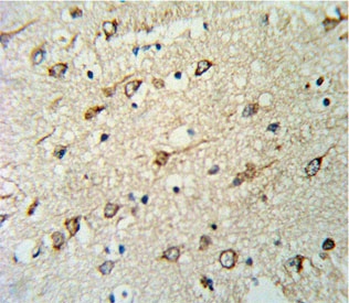 IHC testing of FFPE human brain tissue with DNAJC6 antibody. HIER: steam section in pH6 citrate buffer for 20 min and allow to cool prior to staining.