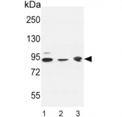 Western blot testing of 1) human K562, 2) human HL60 and 3) mouse brain lysate with DNAJC6 antibody. Predicted molecular weight ~100 kDa.