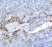 IHC staining of FFPE human tonsil tissue with PD-L1 antibody. HIER: steam section in pH9 EDTA buffer for 20 min and allow to cool prior to staining.