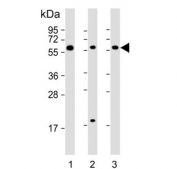 Western blot testing of human 1) HepG2, 2) K562 and 3) Raji cell lysate using TGFB1 antibody. Predicted molecular weight: 44-50 kDa (precursor), ~25 kDa (active form).