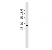 Western blot testing of human HT-29 cell lysate with MyD88 antibody. Predicted molecular weight ~33 kDa.